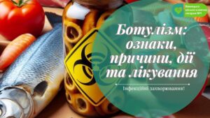ботулізм